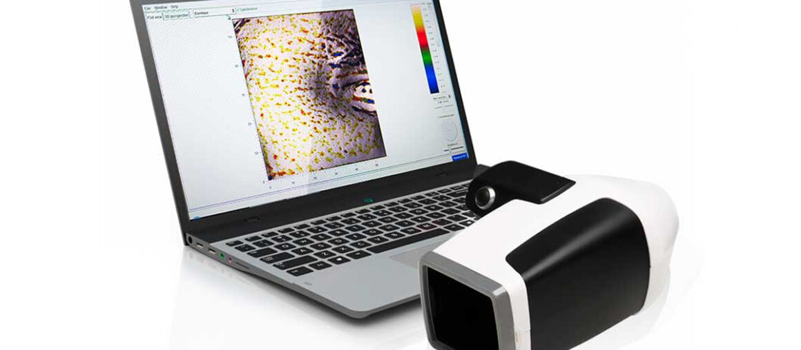 Аппарат Antera3D для цифровой дерматоскопии