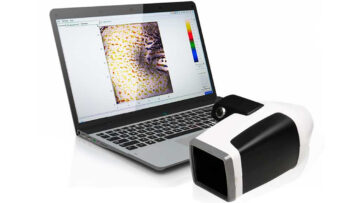 Аппарат Antera3D для цифровой дерматоскопии