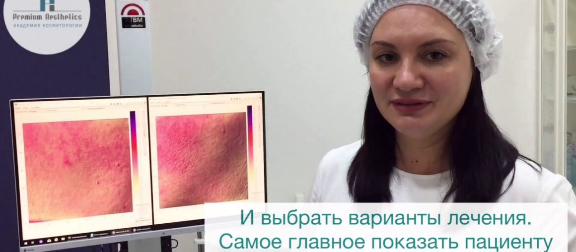 Диагностика кожи на аппарате Antera 3D с Еленой Олейниченко. Мнение эксперта